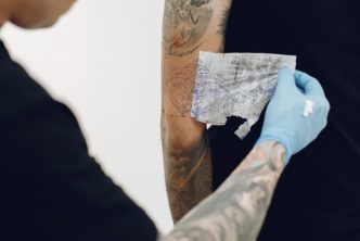 máquina de eliminación de tatuajes