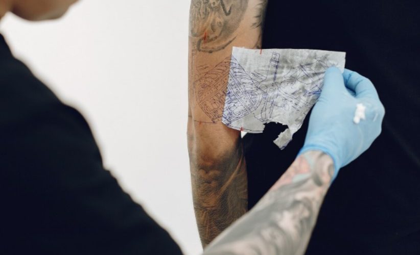 máquina de eliminación de tatuajes